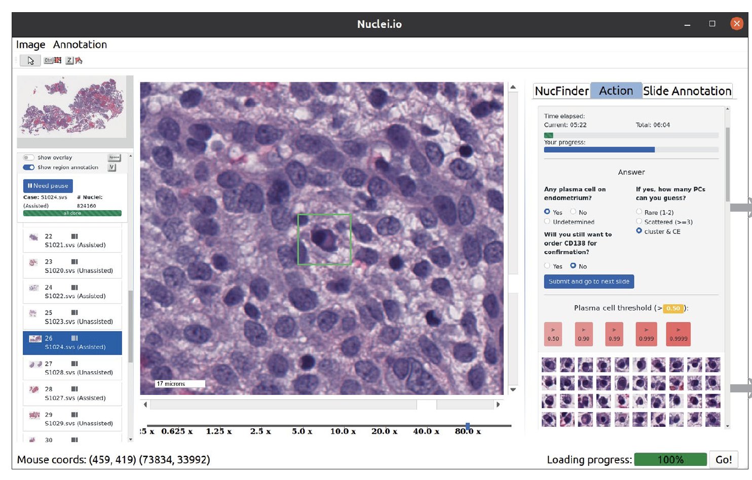 Stanford Researchers Launch Nuclei.io: Revolutionizing Artificial Intelligence AI and Clinician Collaboration for Enhanced Pathology Datasets and Models