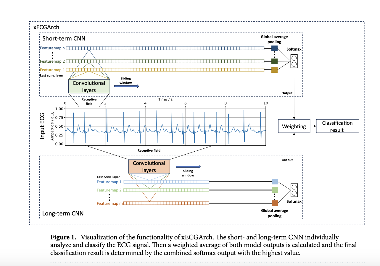  xECGArch: A Multi-Scale Convolutional Neural Network CNN for Accurate and Interpretable Atrial Fibrillation Detection in ECG Analysis