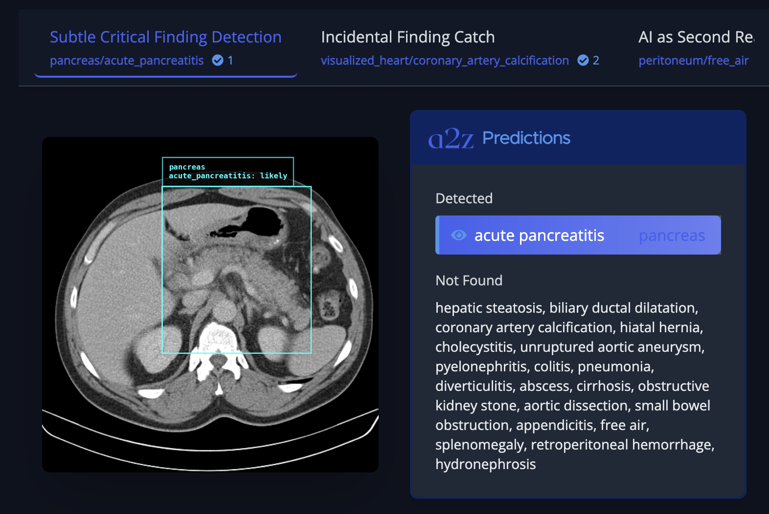 a2z Radiology AI Introduces a2z-1: An AI that Analyzes Abdominal-Pelvis CT Scans and Reports to Catch Potential Misses Across 21 Conditions