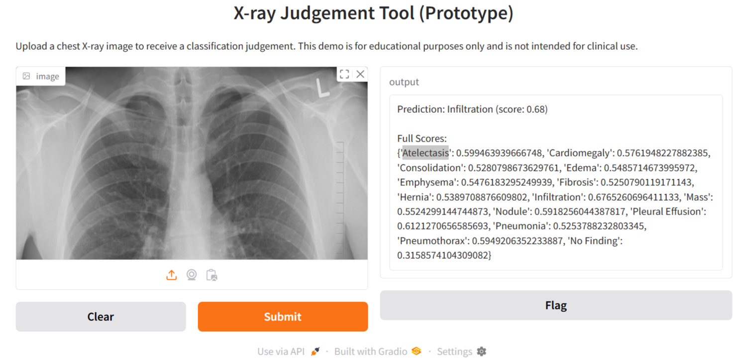 Build an Open Source X-ray Judgment Tool with TorchXRayVision and Gradio